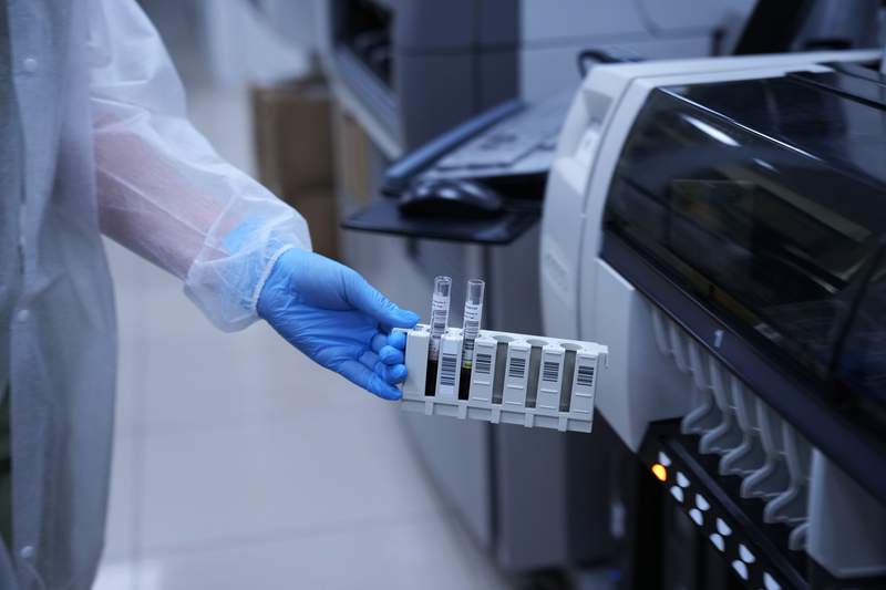 Russia counting on antibody tests; West notes tool's limits