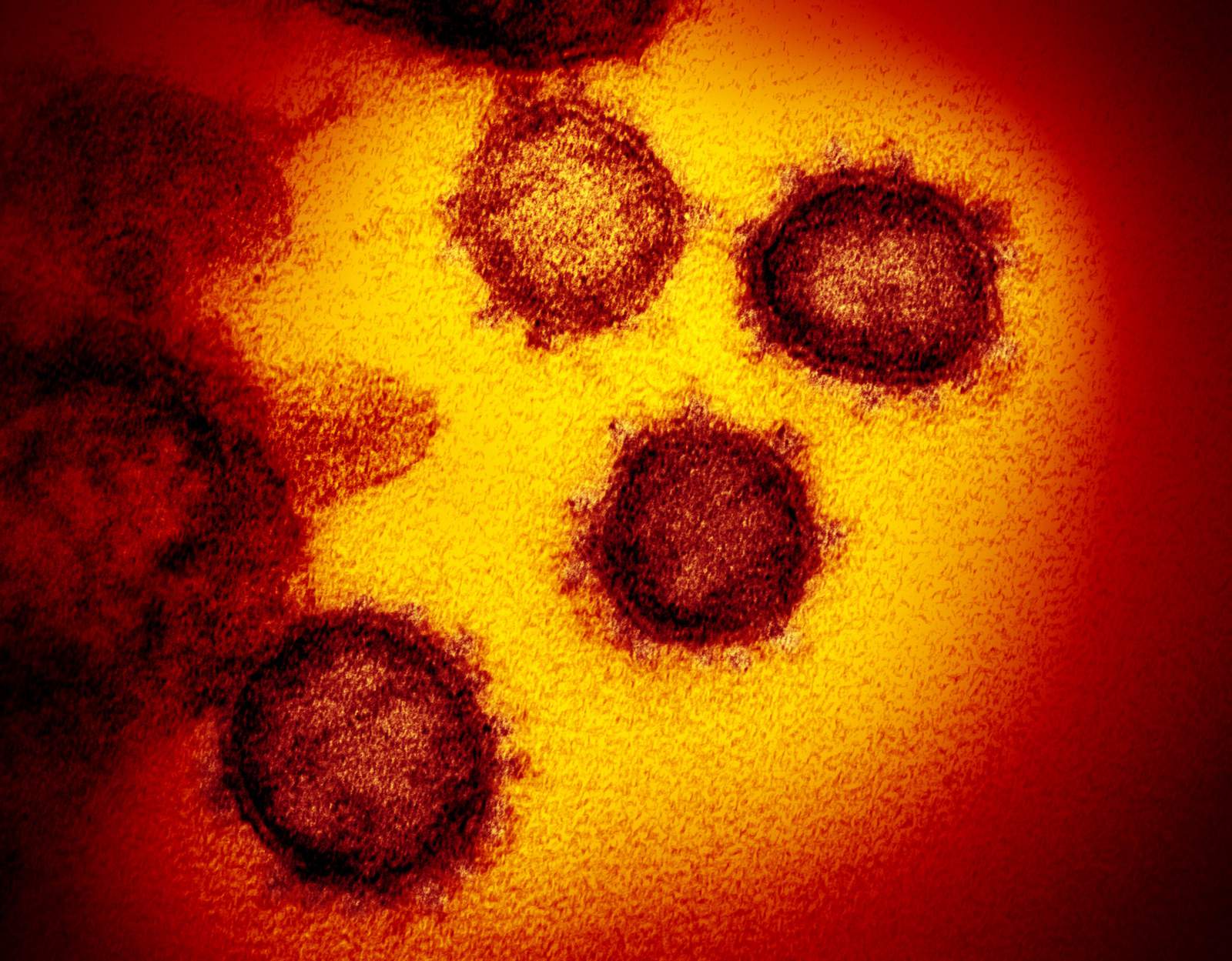 New coronavirus test is imperfect step toward mass screening