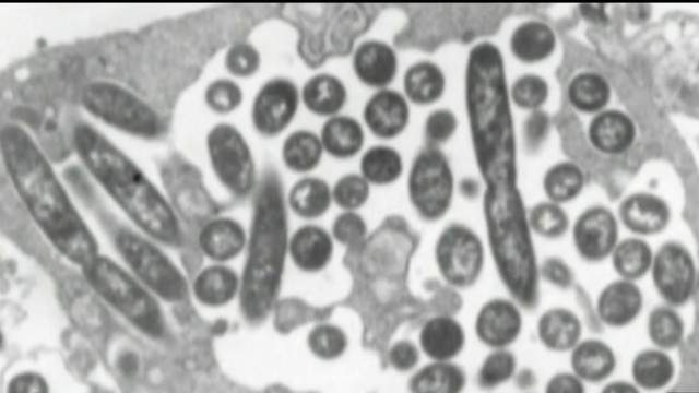 Health Officials Investigating Reported Cases Of Legionnaires