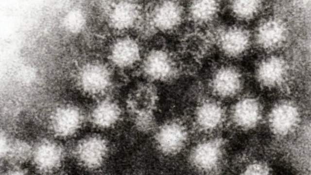 Norovirus outbreak prompts temporary shutdown of Michigan camp
