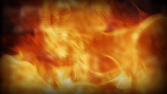 15-year-old boy suffers serious burns after starting Pontiac house on fire