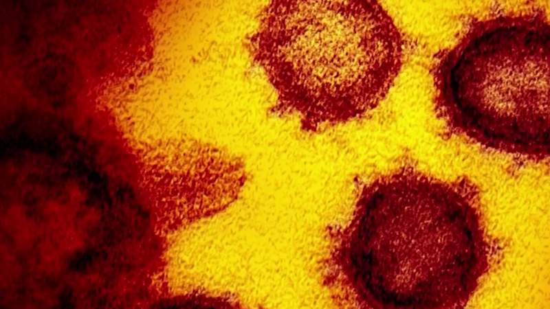 Can you get coronavirus from handling money?