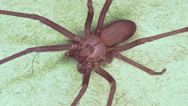 Michigan Teen Recovering From Suspected Recluse Spider Bite