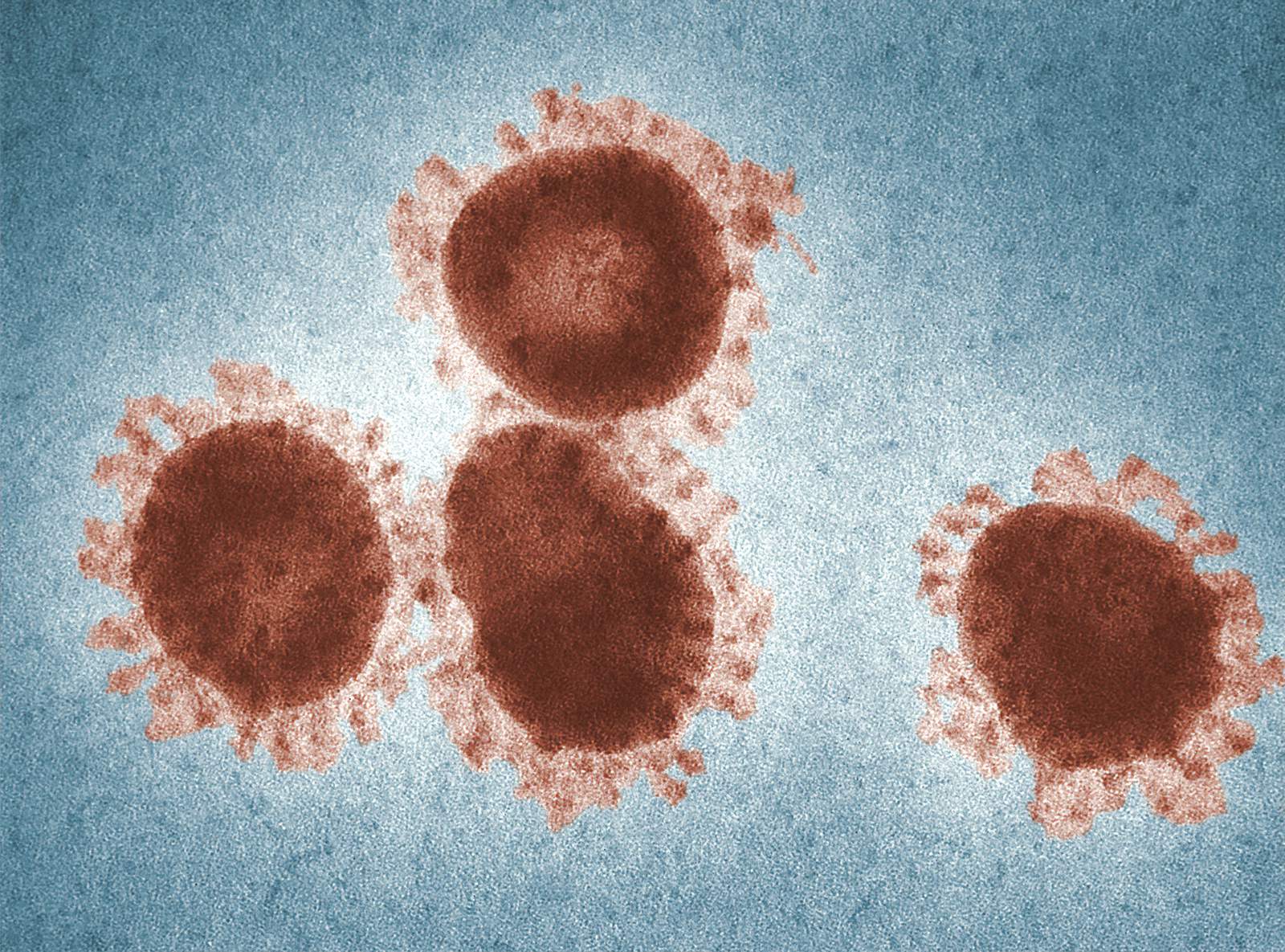 2 Livingston County locations listed as potential coronavirus (COVID-19) exposure sites