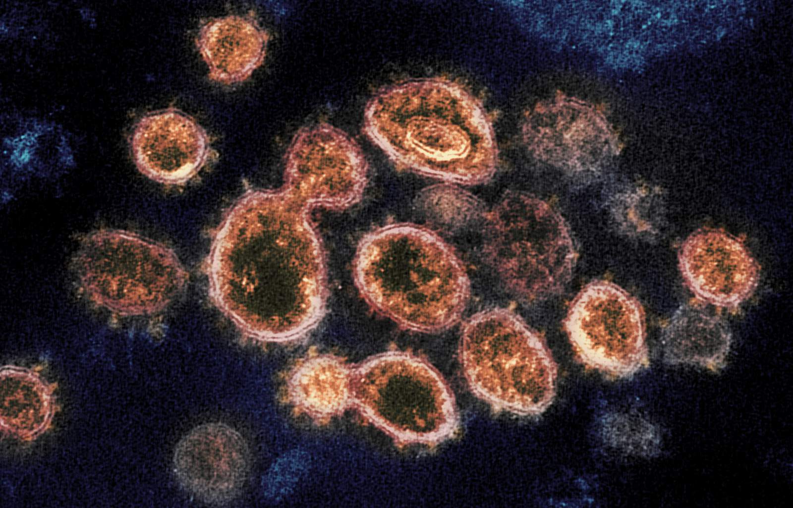 Highly contagious virus variant identified in 3rd Michigan county