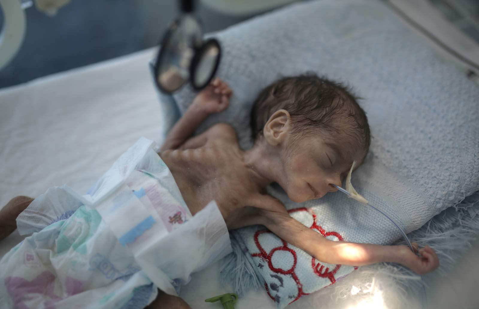 UNICEF: Millions of Yemeni children may starve amid pandemic