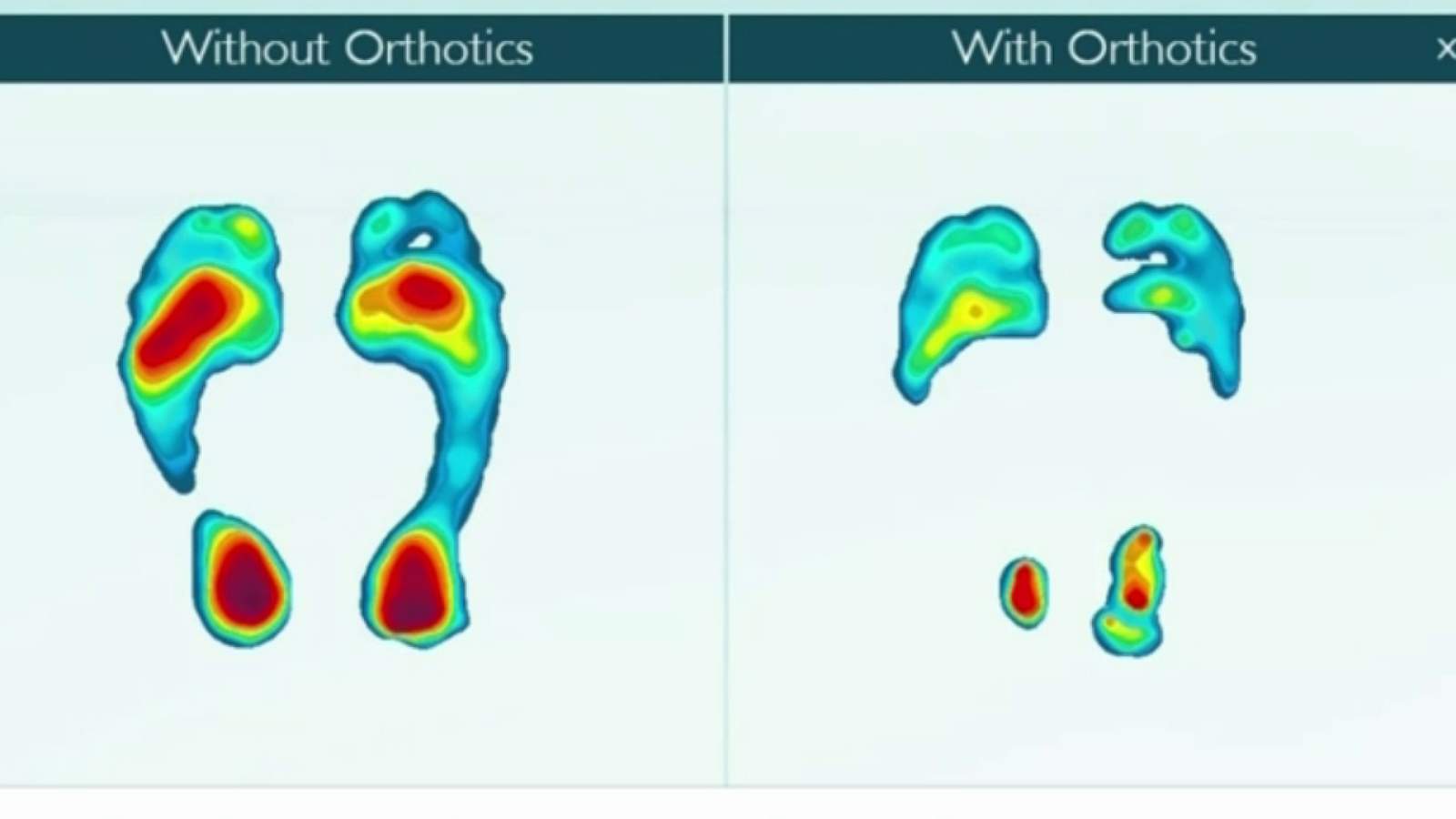 Could you benefit from a foot analysis?